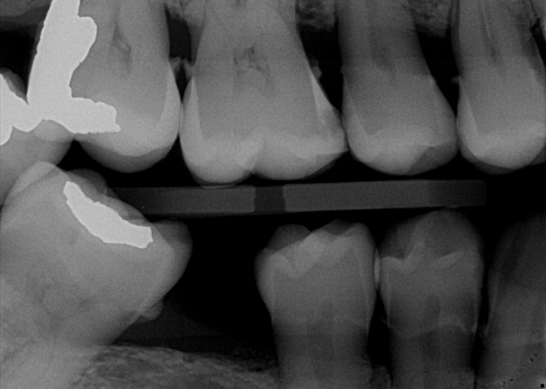 Dentist performing a thorough dental exam at Professional Dental office in Utah