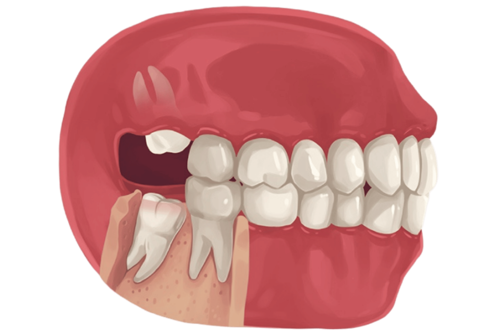 2 9 - Professional Dental