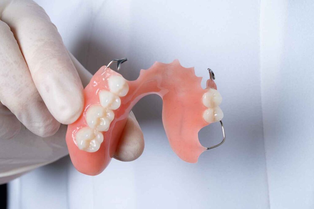 Dentist holding a partial denture, ensuring a comfortable and natural fit for patients