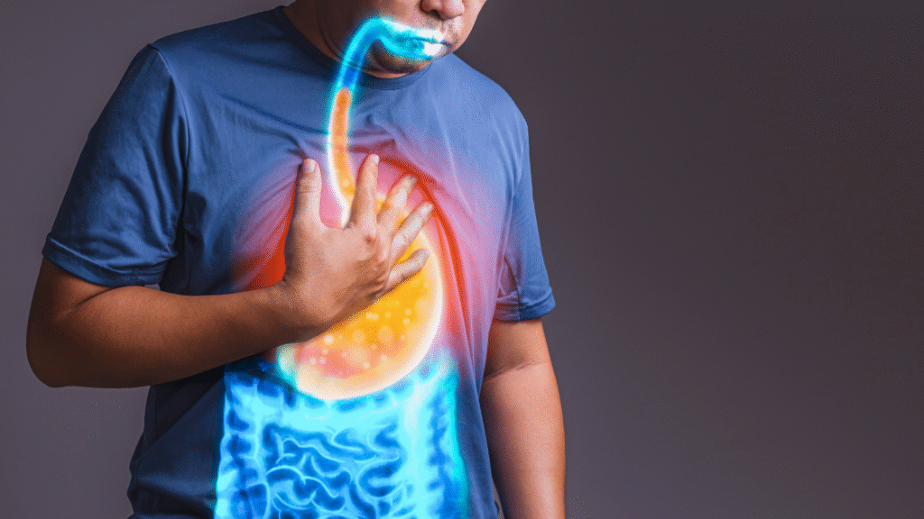 Digestive tract illustration showing inflammation caused by Celiac Disease or gluten sensitivity.