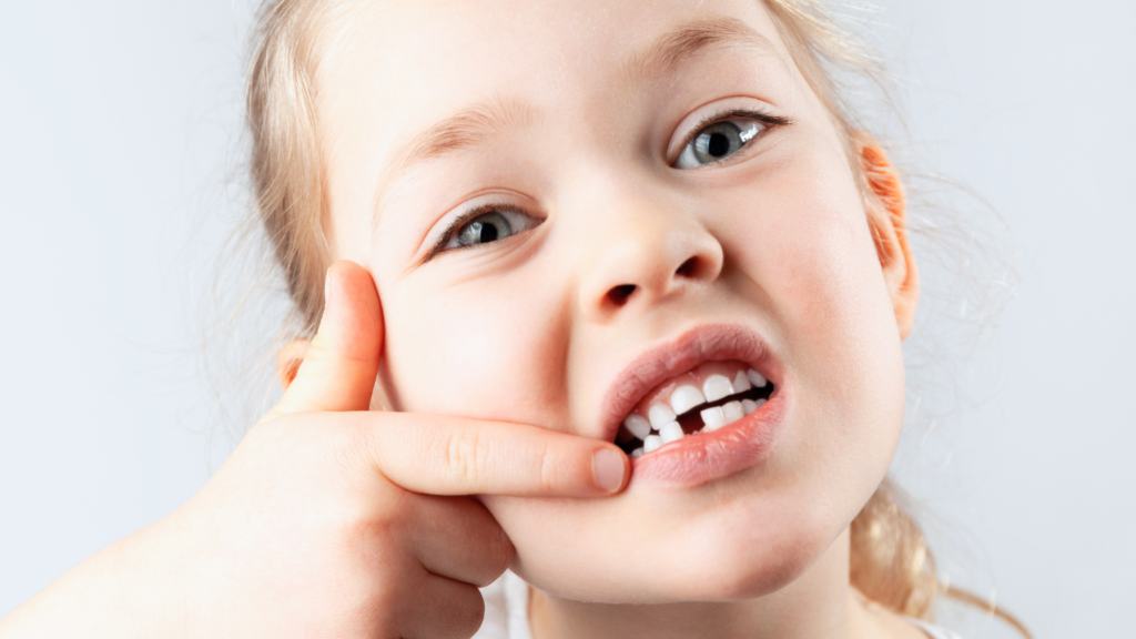 10 Surprising Dental Facts: What You Didn't Know About Your Smile 1 - Professional Dental A joyful young girl showing her loose baby tooth during a dental check-up at Professional Dental in Utah.