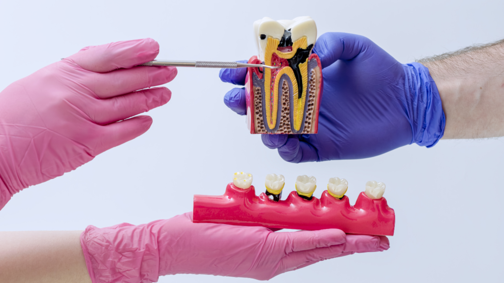 Home 39 - Professional Dental Dental specialist holding a tooth model to explain endodontics and root canal treatments at Professional Dental in Utah.