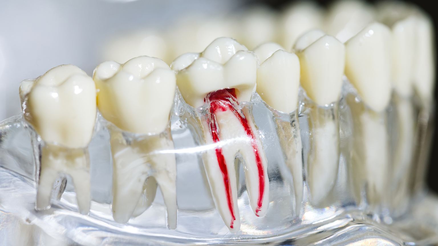 Dentist providing root canal treatment to a patient at Professional Dental in Utah