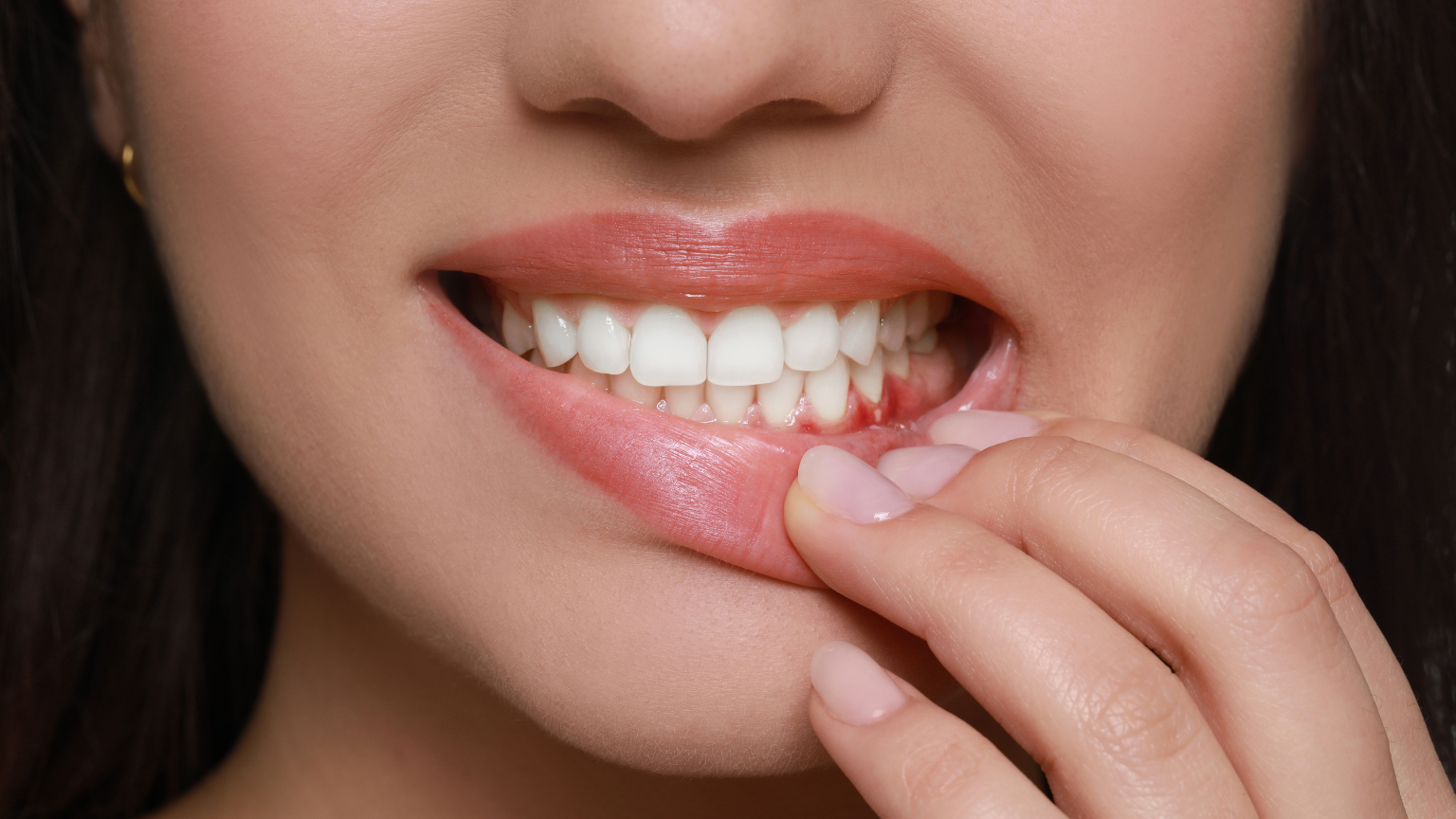 Close-up of healthy gums and teeth illustrating the importance of gum disease prevention and periodontal care.