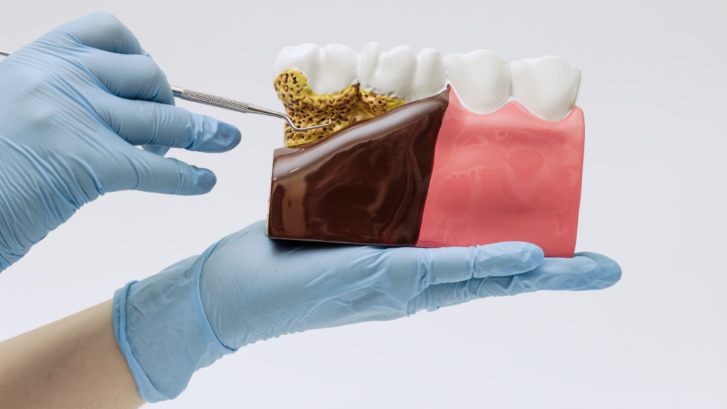 7 Early Signs of Gum Disease You Should Never Ignore 1 - Professional Dental Close-up of healthy gums and teeth illustrating the importance of gum disease prevention and periodontal care.